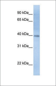 Anti-ITPK1 antibody produced in rabbit affinity isolated antibody