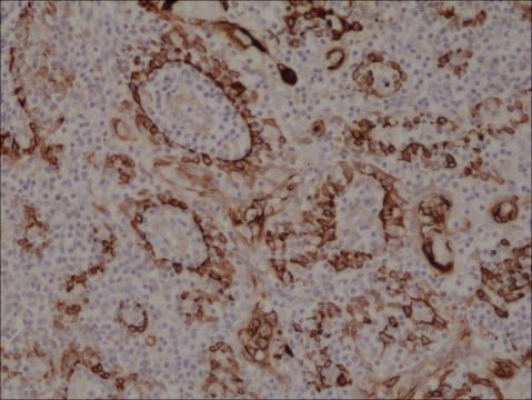 Anti-Cytokeratin 17 (CK-17) antibody, Rabbit monoclonal recombinant, expressed in HEK 293 cells, clone RM351, purified immunoglobulin