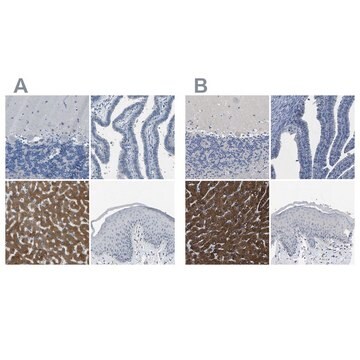 Anti-CYP2C8 antibody produced in rabbit Prestige Antibodies&#174; Powered by Atlas Antibodies, affinity isolated antibody, buffered aqueous glycerol solution