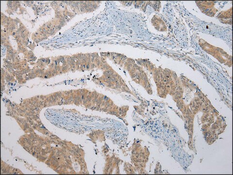 Anti-B4GALT5 affinity isolated antibody