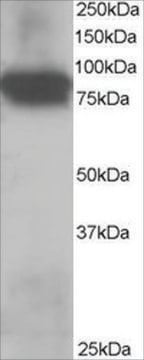 Anti-Plakoglobin/&#947;-Catenin antibody produced in goat affinity isolated antibody, buffered aqueous solution