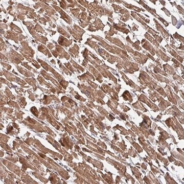 Anti-KIF1C antibody produced in rabbit Prestige Antibodies&#174; Powered by Atlas Antibodies, affinity isolated antibody, buffered aqueous glycerol solution