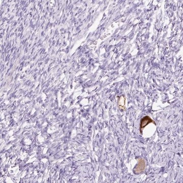 Anti-GBX1 antibody produced in rabbit Prestige Antibodies&#174; Powered by Atlas Antibodies, affinity isolated antibody, buffered aqueous glycerol solution