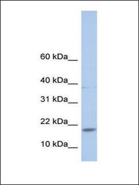 Anti-MAX antibody produced in rabbit affinity isolated antibody