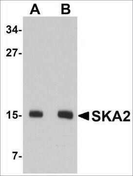 Anti-SKA2 antibody produced in rabbit affinity isolated antibody, buffered aqueous solution