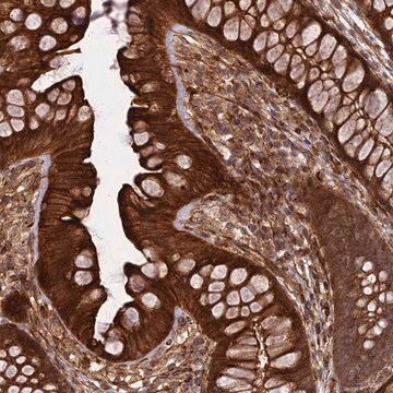 Anti-PHLDB3 antibody produced in rabbit Prestige Antibodies&#174; Powered by Atlas Antibodies, affinity isolated antibody, buffered aqueous glycerol solution