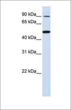 Anti-RHBDF1 affinity isolated antibody