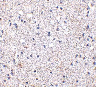 Anti-SCO1 antibody produced in rabbit affinity isolated antibody, buffered aqueous solution