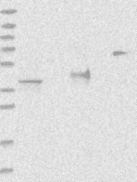 Anti-ADPRS antibody produced in rabbit Prestige Antibodies&#174; Powered by Atlas Antibodies, affinity isolated antibody, buffered aqueous glycerol solution