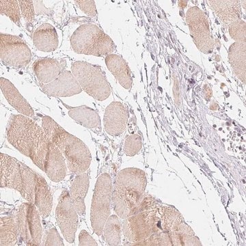 Anti-DENND2C antibody produced in rabbit Prestige Antibodies&#174; Powered by Atlas Antibodies, affinity isolated antibody, buffered aqueous glycerol solution