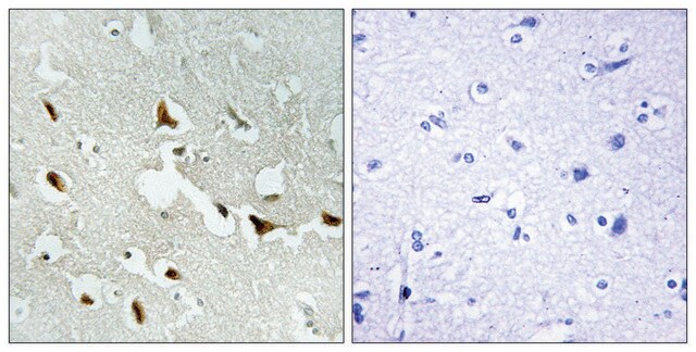 Anti-IRS-1 antibody produced in rabbit affinity isolated antibody