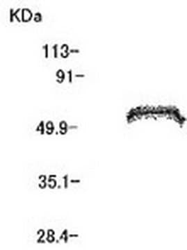 Anti-MT1-MMP (Ab-4) Mouse mAb (113-5B7) liquid, clone 113-5B7, Calbiochem&#174;