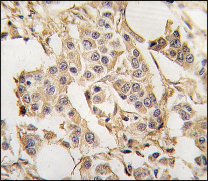 Anti-PARS2 (center) antibody produced in rabbit saturated ammonium sulfate (SAS) precipitated, buffered aqueous solution