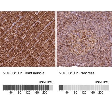 Anti-NDUFB10 antibody produced in rabbit Prestige Antibodies&#174; Powered by Atlas Antibodies, affinity isolated antibody