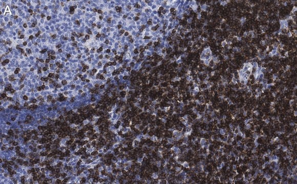 Anti-CD5 Antibody, clone 1C19 Antibody, ZooMAb&#174; Rabbit Monoclonal recombinant, expressed in HEK 293 cells