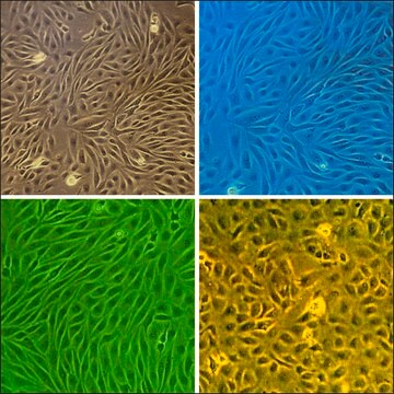 Bovine Brain Microvascular Endothelial Cells: BBMVEC (Cryovial)