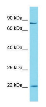 Anti-OGFR (C-terminal) antibody produced in rabbit affinity isolated antibody