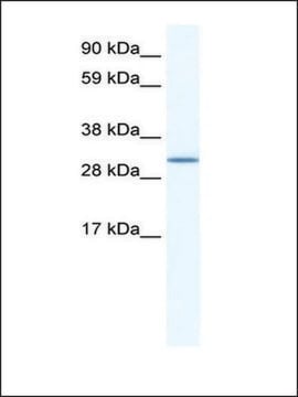 Anti-SPIC antibody produced in rabbit IgG fraction of antiserum