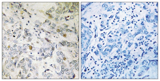 Anti-HCC1 antibody produced in rabbit affinity isolated antibody