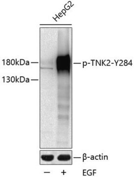 Anti-Phospho-TNK2-Y284 antibody produced in rabbit