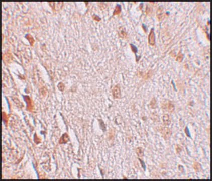 Anti-WIZ antibody produced in rabbit affinity isolated antibody, buffered aqueous solution