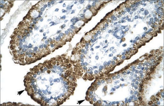 Anti-GABRP antibody produced in rabbit affinity isolated antibody