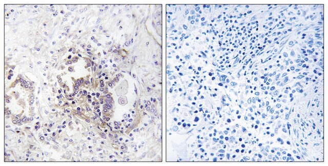 Anti-CHML antibody produced in rabbit affinity isolated antibody