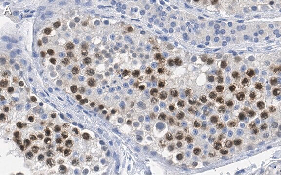 Anti-RAD51 Antibody, clone 1M8 ZooMAb&#174; Rabbit Monoclonal recombinant, expressed in HEK 293 cells