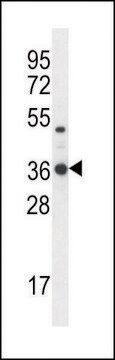 ANTI-TPSD1 (C-TERM) antibody produced in rabbit IgG fraction of antiserum, buffered aqueous solution