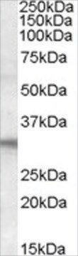 Anti-FHL2 antibody produced in goat affinity isolated antibody, buffered aqueous solution