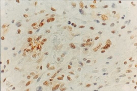 Anti-MGMT Antibody, clone MT3.1 clone MT3.1, Chemicon&#174;, from mouse