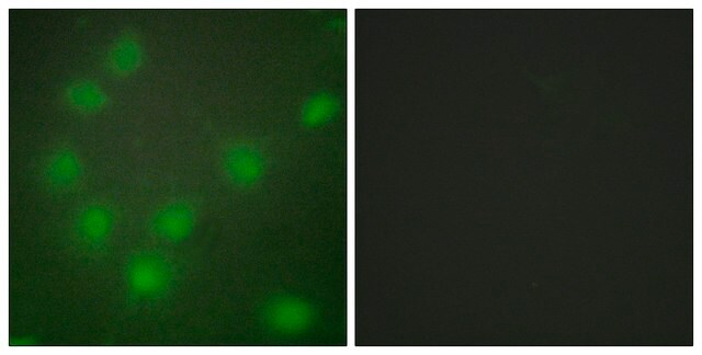 Anti-HOXA11 antibody produced in rabbit affinity isolated antibody