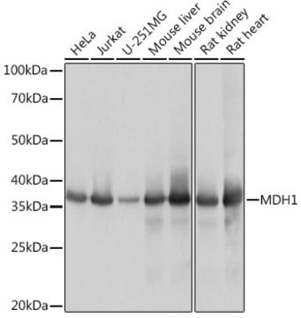 Anti-MDH1 Antibody, clone 8U9X1, Rabbit Monoclonal