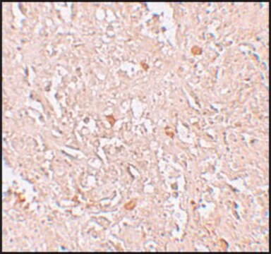 Anti-FBXL16 antibody produced in rabbit affinity isolated antibody, buffered aqueous solution