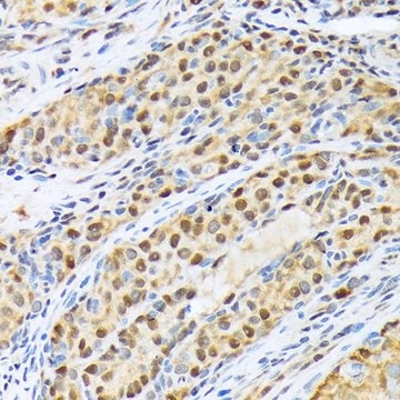 Anti-FKBP51/FKBP5 antibody produced in rabbit