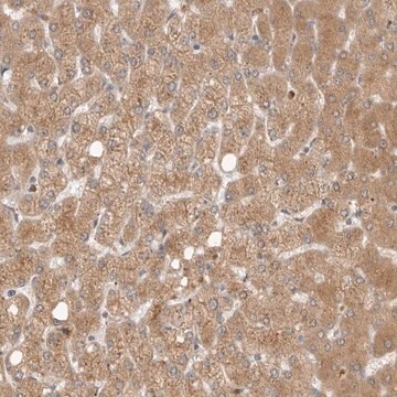 Anti-GNE antibody produced in rabbit Prestige Antibodies&#174; Powered by Atlas Antibodies, affinity isolated antibody, buffered aqueous glycerol solution