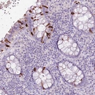 Anti-BLOC1S2 antibody produced in rabbit Prestige Antibodies&#174; Powered by Atlas Antibodies, affinity isolated antibody, buffered aqueous glycerol solution