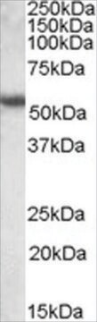 Anti-KRT13 antibody produced in goat affinity isolated antibody, buffered aqueous solution