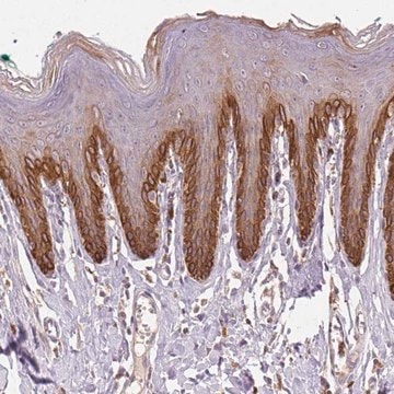 Anti-TMEM253 antibody produced in rabbit Prestige Antibodies&#174; Powered by Atlas Antibodies, affinity isolated antibody, buffered aqueous glycerol solution