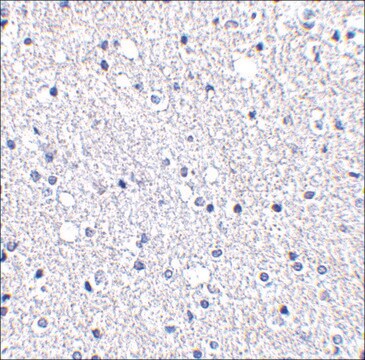 Anti-TIGAR (ab1) antibody produced in rabbit affinity isolated antibody, buffered aqueous solution