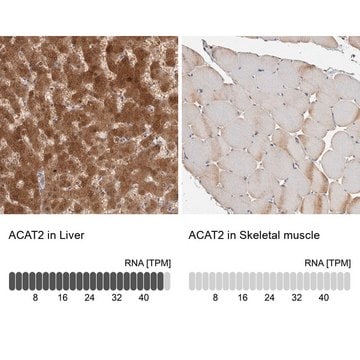 Anti-ACAT2 antibody produced in rabbit Prestige Antibodies&#174; Powered by Atlas Antibodies, affinity isolated antibody, buffered aqueous glycerol solution, Ab2