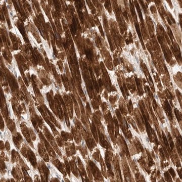 Anti-KIF1C antibody produced in rabbit Prestige Antibodies&#174; Powered by Atlas Antibodies, affinity isolated antibody, buffered aqueous glycerol solution, Ab2