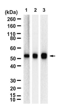 Anti-CaM Kinase II β Antibody, clone 1F13 ZooMAb&#174; Rabbit Monoclonal recombinant, expressed in HEK 293 cells