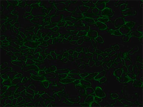 Luciferase-luciferin suitable for determination of ATP released from blood platelets., powder