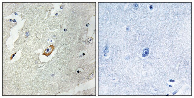 Anti-CDC16 antibody produced in rabbit affinity isolated antibody