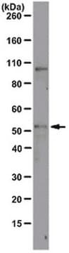 Anti-ODC1 Antibody, clone CPTC-ODC1-2 clone CPTC-ODC1-2, from mouse