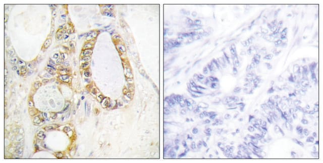 Anti-MUC13 antibody produced in rabbit affinity isolated antibody