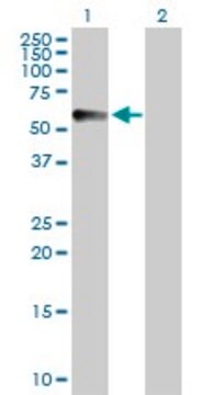 Anti-CPVL antibody produced in rabbit purified immunoglobulin, buffered aqueous solution