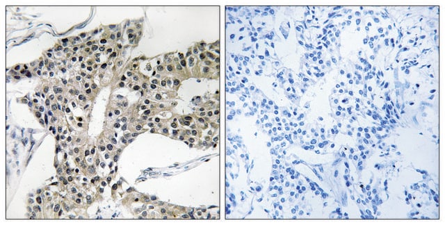 Anti-ARSK antibody produced in rabbit affinity isolated antibody