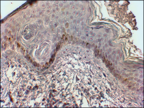 Anti-CMA1 antibody produced in goat affinity isolated antibody, buffered aqueous solution